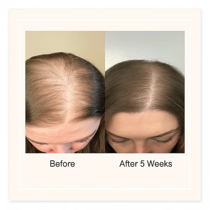 Be Bodywise Advanced Hair Growth Roll-On Serum | 3% Rosemary | 2% Aminexil | 3% Redensy l 2% Anagain | Precision Scalp Applicator | Paraben & Sulphate Free | Non oily and mess free